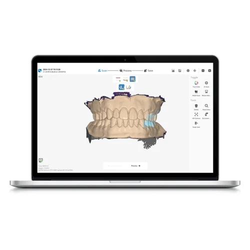 Digital impression workflow in dental CAD software