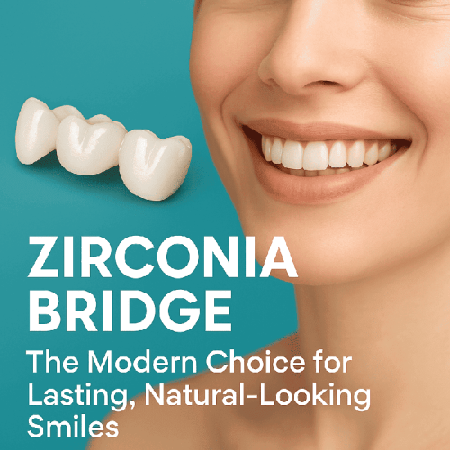 Zirconia Bridge: The Modern Choice for Lasting, Natural-Looking Smiles Featured Image