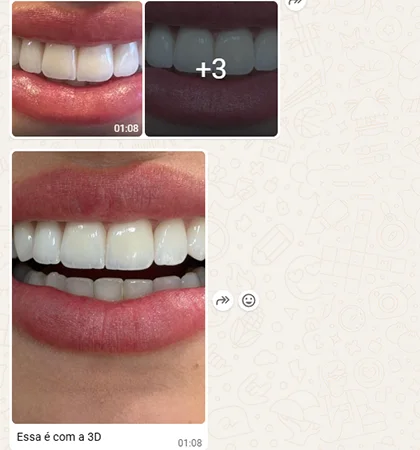 Clinical-side WhatsApp feedback and smile photos for the BL1 veneer case