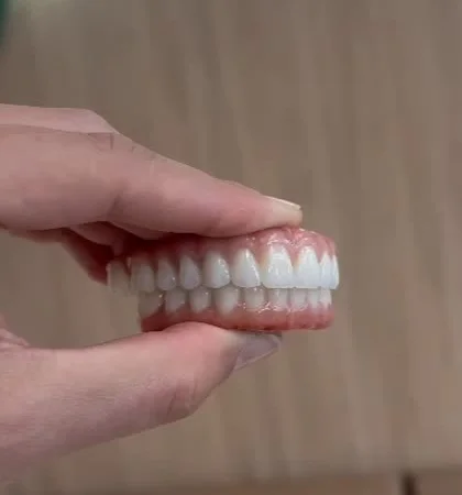 BL1 full-arch zirconia restorations fabricated by a Brazilian dental laboratory