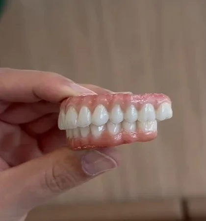Alternate lab-side view of the BL1 full-arch zirconia restoration