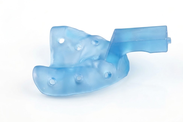 3D printed custom dental impression tray made with Custom Tray Resin