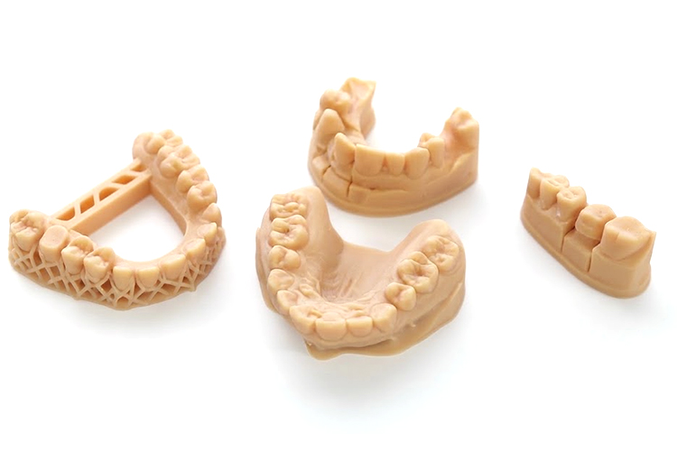 3D printed dental models made with dental model resin