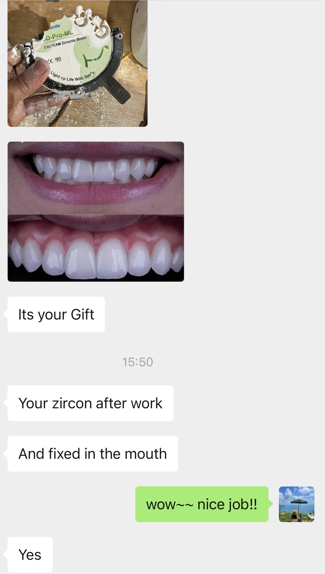 Customer chat showing Ownsmile 3D Pro ML zirconia and the completed BL1 restoration